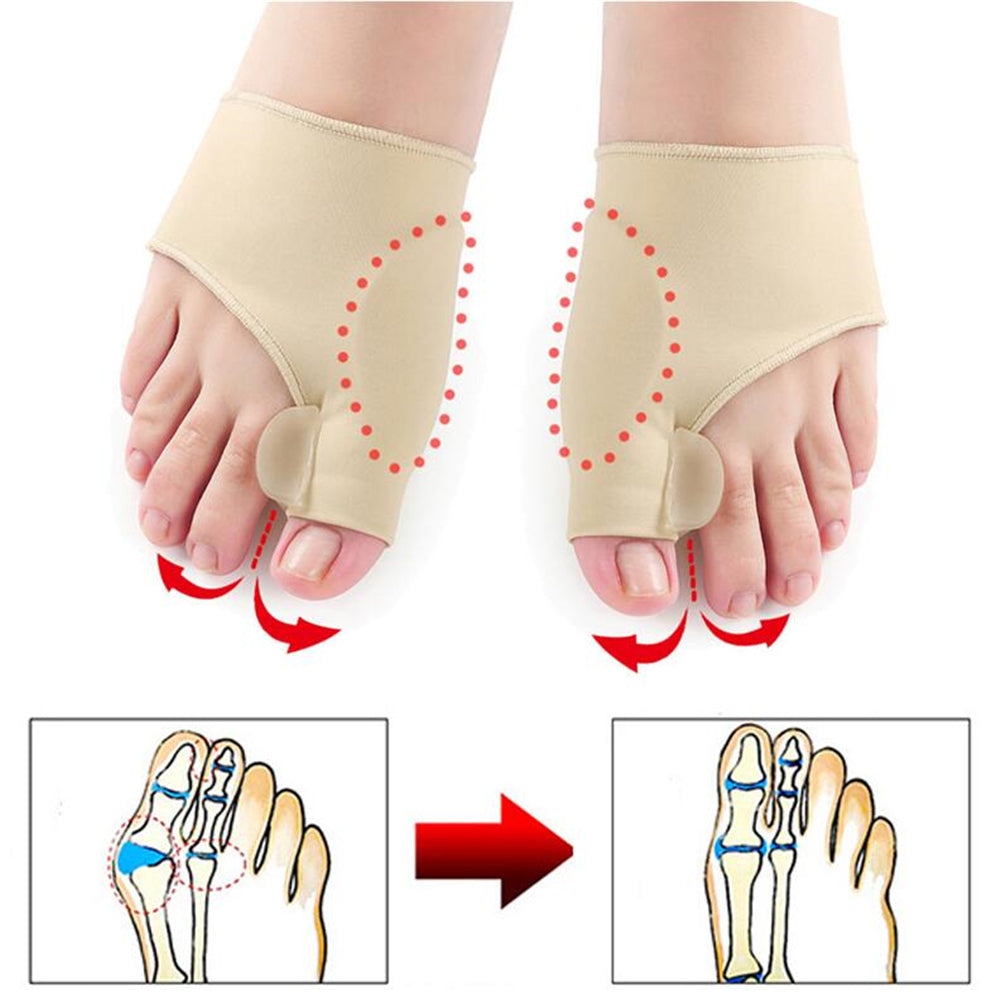 Orthopedic Bunion Correction -Foot Care Tool