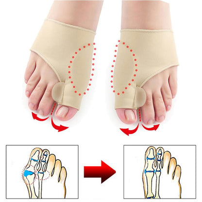 Orthopedic Bunion Correction -Foot Care Tool